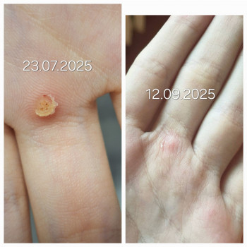 Анжела Кротенко, Кропивницький Фото - 20