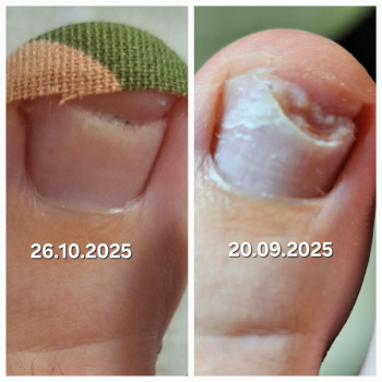 Анжела Кротенко, Кропивницький Фото - 21