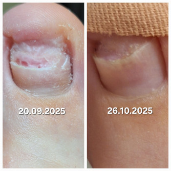 Анжела Кротенко, Кропивницький Фото - 22