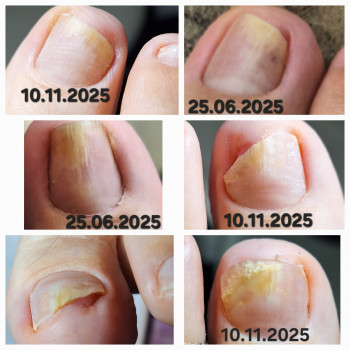 Анжела Кротенко, Кропивницький Фото - 24