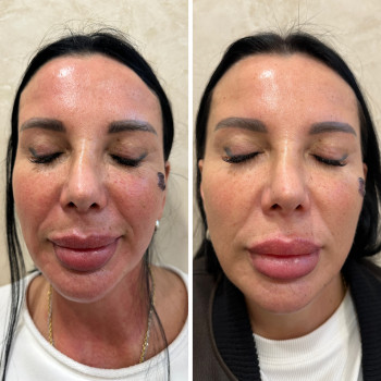 Анна Литовченко, Одесса Фото - 5