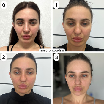 Анна Литовченко, Одесса Фото - 6