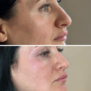 Анна Литовченко, Одесса Фото - 11