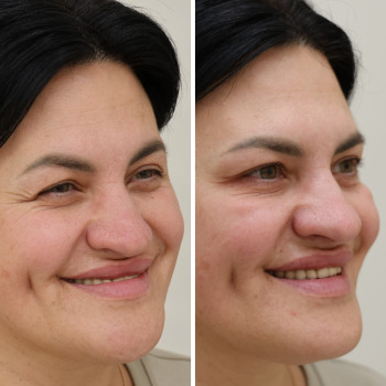 Анна Литовченко, Одесса Фото - 13