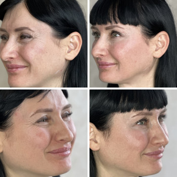 Анна Литовченко, Одесса Фото - 14