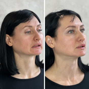 Анна Литовченко, Одесса Фото - 15