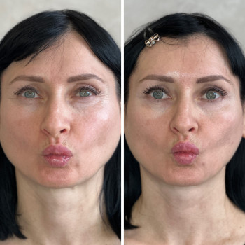 Анна Литовченко, Одесса Фото - 17