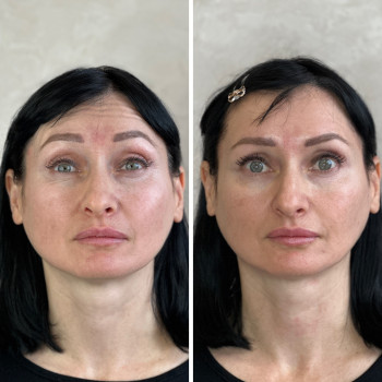 Анна Литовченко, Одесса Фото - 18