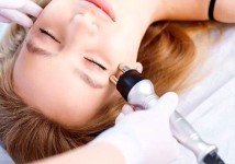 Акція -25%🔥 на процедуру RF ліфтинга 🥰 Постпроцедурний кабінетний заспокійливий догляд-у подарунок 🎁 Косметолог  Хмельницкий