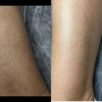 Катерина Кальченко, Днепр Фото - 6