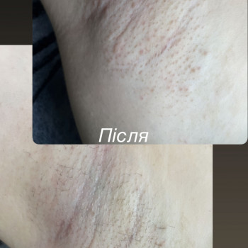 Катерина Кальченко, Днепр Фото - 9