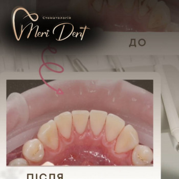 Meri Dent, Кам'янець-Подільський Фото - 5