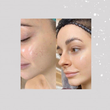 Тетяна Гранат, Вишгород Фото - 5