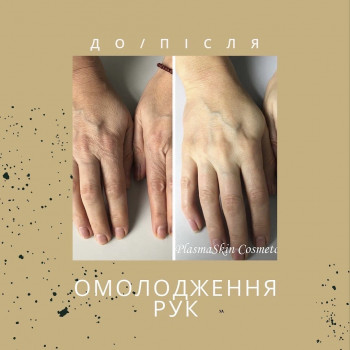 Тетяна Гранат, Вишгород Фото - 7