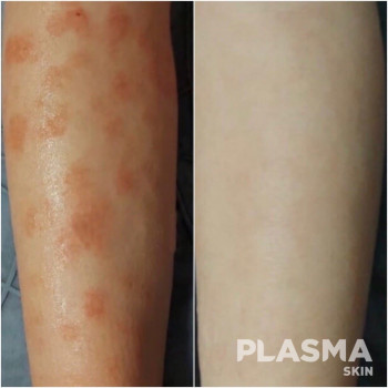 Тетяна Гранат, Вишгород Фото - 8