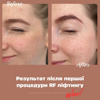 Лілія Дмитрук, Хмельницький Фото - 6