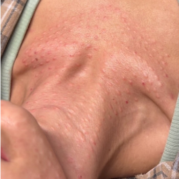 Glowface, Хмельницкий Фото - 5