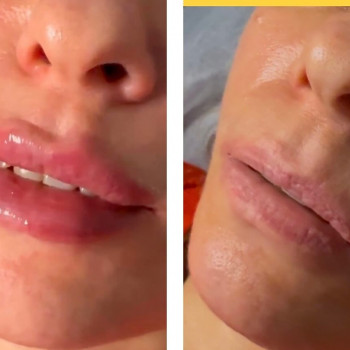 Фото з портфоліо косметолога Наталя Ільчишена (Хмельницький)