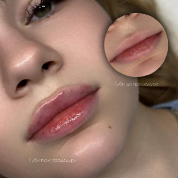 Елена Долга, Хмельницкий Фото - 5