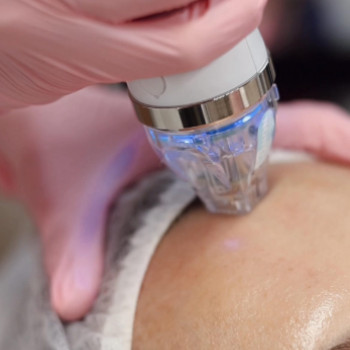 Анна Якобчук, Хмельницький Фото - 5