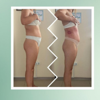 Меняйся!, Хмельницкий Фото - 5