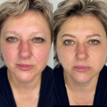 Анна Земляк, Ужгород Фото - 4