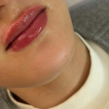 Анна Дереновська, Хмельницький Фото - 5