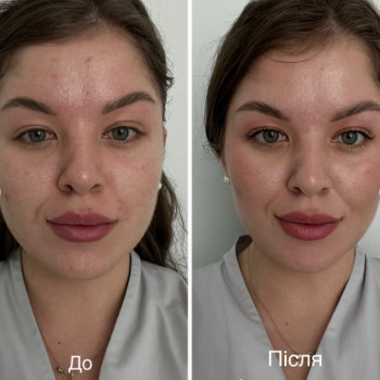 Карана Колесник, Хмельницкий Фото - 5