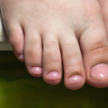 Аліна Дерлеменко, Васильков Фото - 10