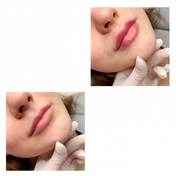 Алиса Гордієнко, Киев Фото - 24