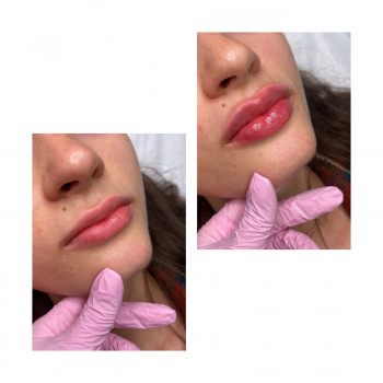 Алиса Гордієнко, Киев Фото - 26