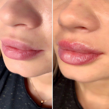 Алиса Гордієнко, Киев Фото - 31