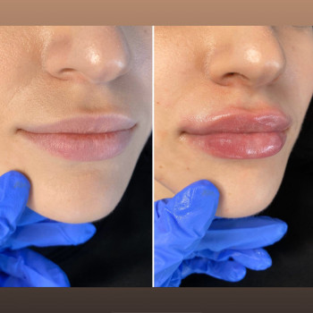 Алиса Гордієнко, Киев Фото - 34