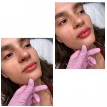 Алиса Гордієнко, Киев Фото - 17