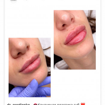 Алиса Гордієнко, Киев Фото - 7