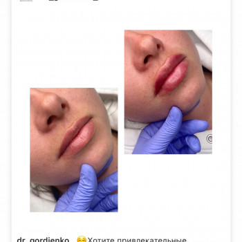 Алиса Гордієнко, Киев Фото - 13