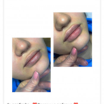 Алиса Гордієнко, Киев Фото - 14