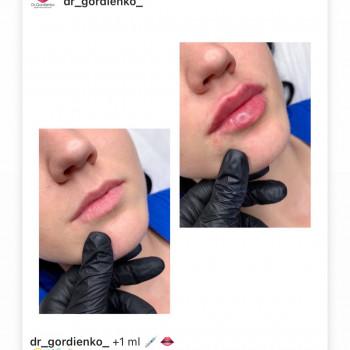 Алиса Гордієнко, Киев Фото - 16