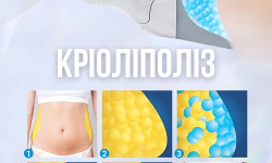 Криолиполиз Косметологічний центр Med Laser Одеса