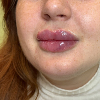 Аніта Татарова, Черноморск Фото - 6