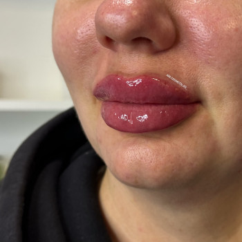 Аніта Татарова, Черноморск Фото - 7