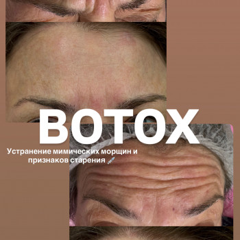 Аніта Татарова, Черноморск Фото - 8