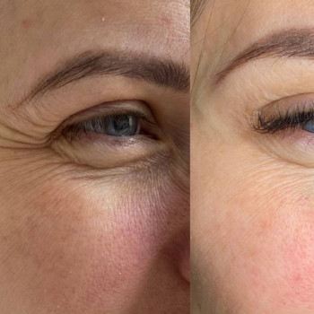 Аніта Татарова, Черноморск Фото - 9