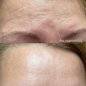 Аніта Татарова, Черноморск Фото - 12