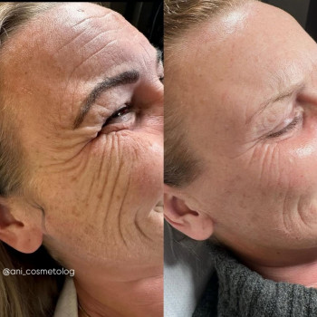 Аніта Татарова, Черноморск Фото - 14