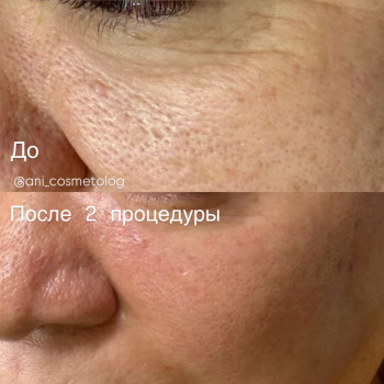 Аніта Татарова, Черноморск Фото - 15