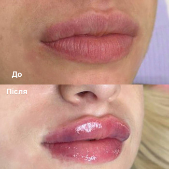 Аніта Татарова, Черноморск Фото - 18