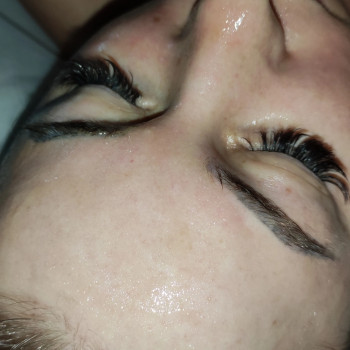 Массаж лица карбокситерапия