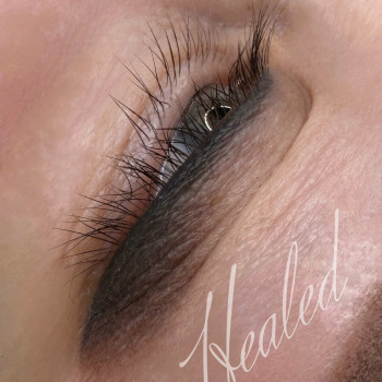 Загоєні тіні