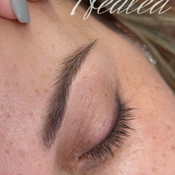 Загоєні волоски